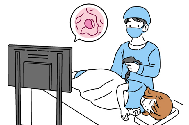 大腸内視鏡検査を行う様子